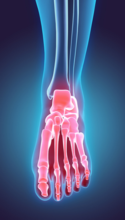 Common foot and ankle disorders